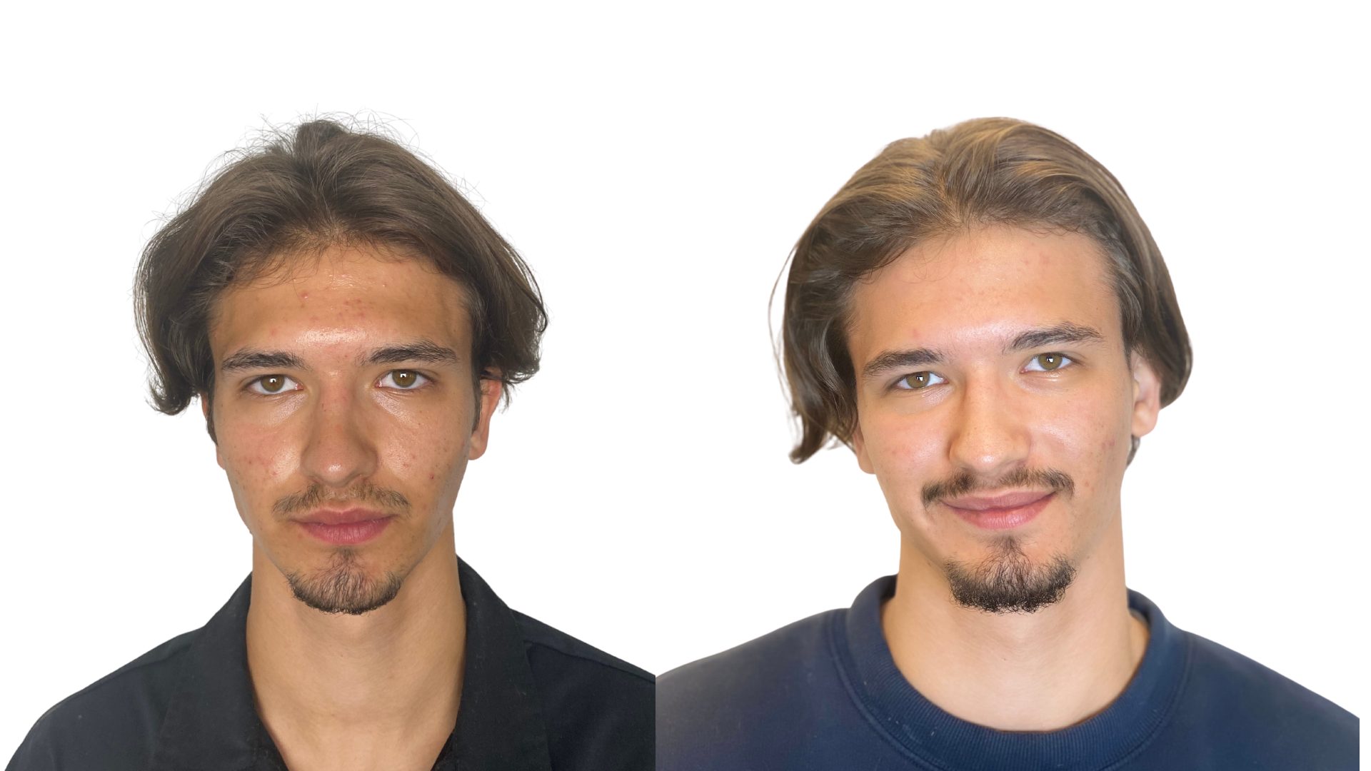 Dariaus odos gydymo rezultatai